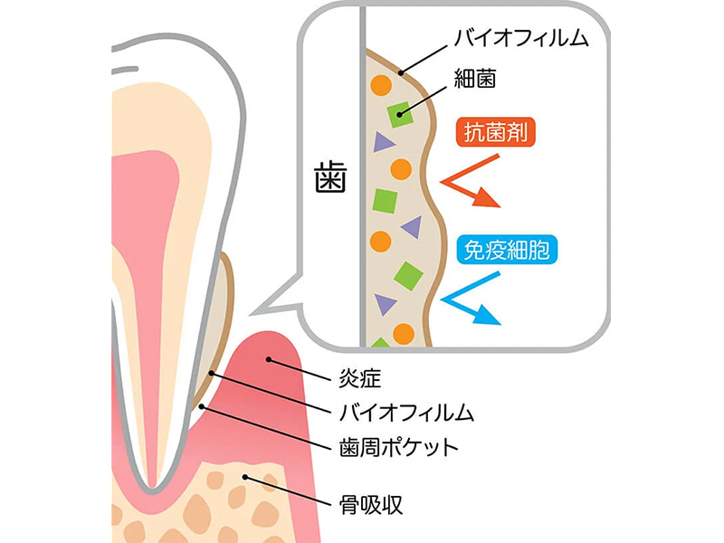 矢口渡（大田区・蒲田）の歯医者、のびのび歯科・矯正歯科の予防歯科