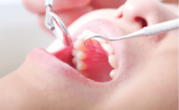 矢口渡（大田区・蒲田）の歯医者、のびのび歯科・矯正歯科で矯正歯科治療