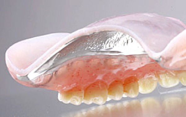 矢口渡（大田区・蒲田）の歯医者、のびのび歯科・矯正歯科で義歯