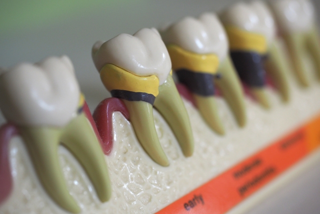 矢口渡（大田区・蒲田）の歯医者、のびのび歯科・矯正歯科の歯周病治療