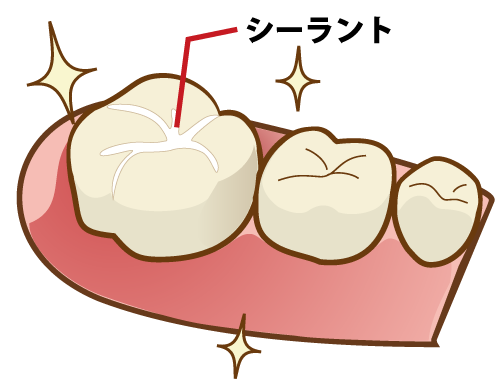 矢口渡（大田区・蒲田）の歯医者、のびのび歯科・矯正歯科で小児歯科