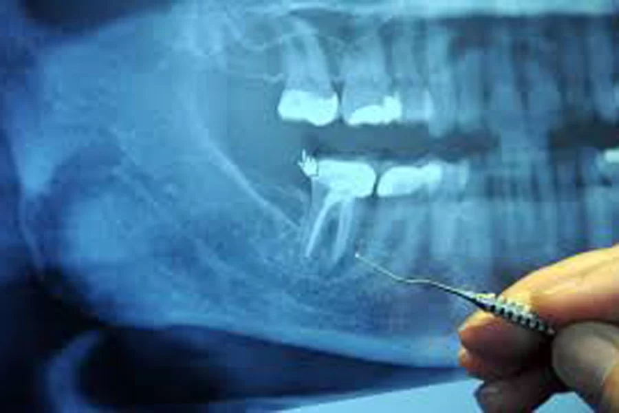 矢口渡（大田区・蒲田）の歯医者、のびのび歯科・矯正歯科でマタニティ歯科